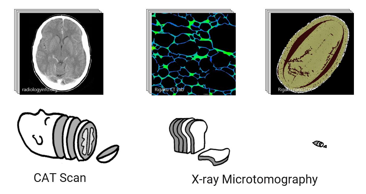 Xray Computed Tomography A Brief Introduction